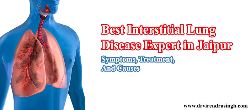 Best Interstitial Lung Disease Expert in Jaipur