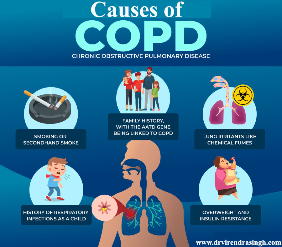 Best COPD Expert in Jaipur and Best Pulmonologist in Jaipur, India