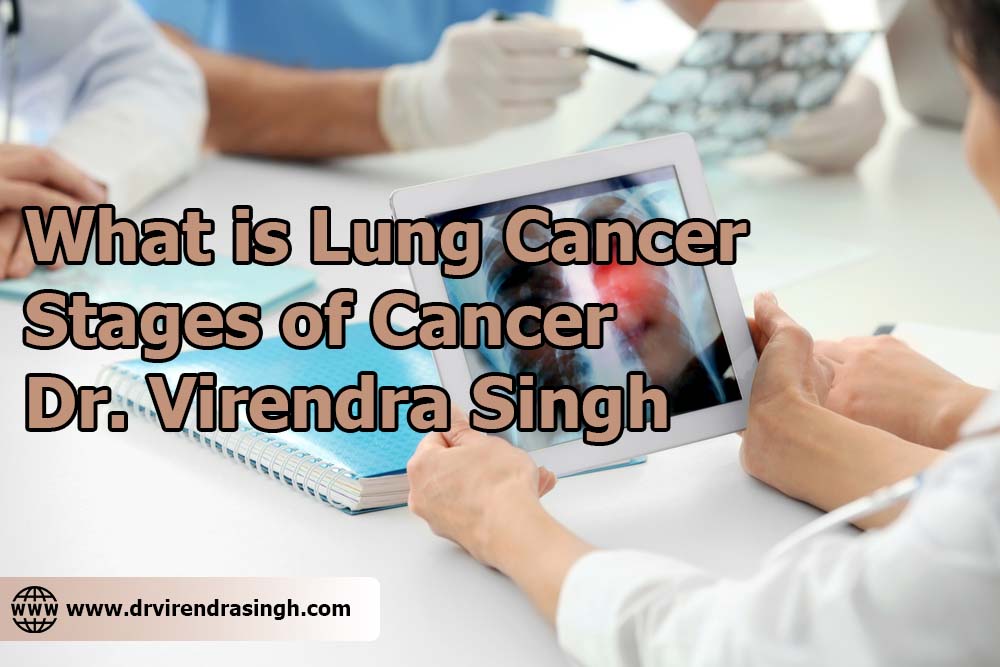 What is Lung Cancer Stages of Cancer Dr. Virendra Singh