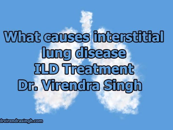 What causes interstitial lung disease ILD Treatment Dr. Virendra Singh