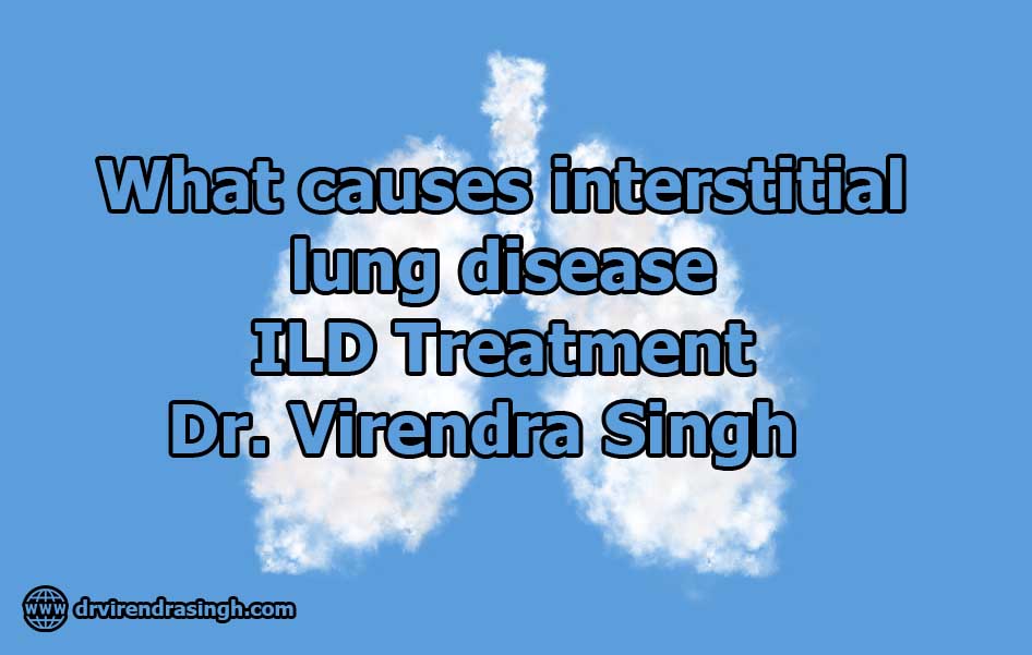 What causes interstitial lung disease ILD Treatment Dr. Virendra Singh