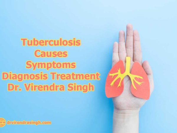 Tuberculosis Causes, Symptoms, Diagnosis, Treatment - Dr. Virendra Singh