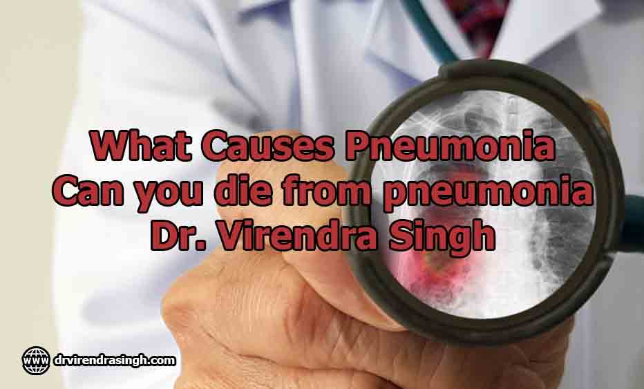 What Causes Pneumonia Can you die from pneumonia Dr. Virendra Singh