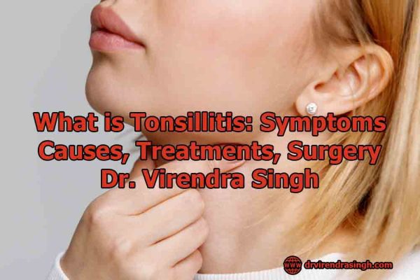 What Is Tonsillitis: Symptoms, Causes, Treatments - Dr. Virendra Singh