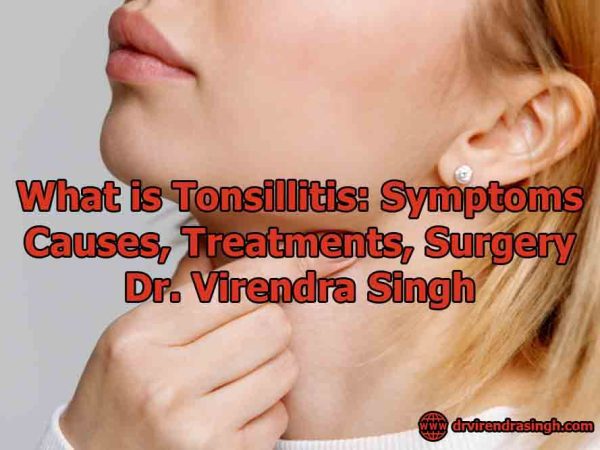 What is Tonsillitis Symptoms, Causes, Treatments, Surgery - Dr. Virendra Singh