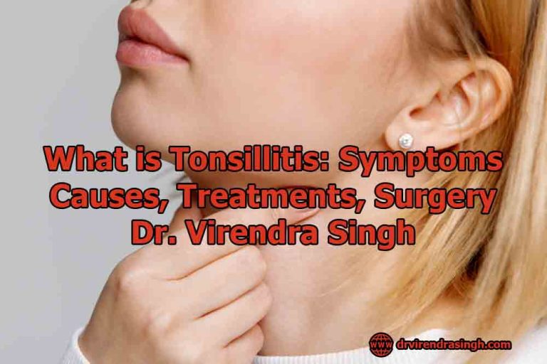 what-is-tonsillitis-symptoms-causes-treatments-dr-virendra-singh