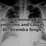 What is Pulmonary Edema? Symptoms and causes- Dr. Virendra Singh.
