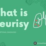 What is Pleurisy Causes, Symptoms, Diagnosis